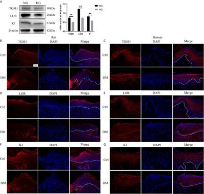 c-Myc Upregulated by High Glucose Inhibits HaCaT Differentiation by S100A6 Transcriptional Activation